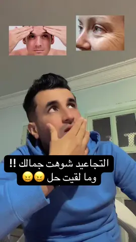 المكونات: 	•	ملعقة صغيرة خميرة فورية 	•	ملعقة صغيرة نشاء 	•	ملعقة كبيرة زبادي طبيعي الطريقة: 	1.	اخلطي المكونات كامل حتى تولّي عندك عجينة ناعمة. 	2.	ديريها على وجهك 15–20 دقيقة. 	3.	اغسلي بماء دافئ ثم بارد. 	4.	كرريها 2 مرات في الأسبوع فقط. ⭐ النتيجة: 	•	تفتيح طبيعي 	•	شدّ للمسام 	•	تهدئة الاحمرار 	•	نعومة وترطيب 