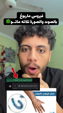 ڤيروس ماربورغ وازاي نحصن نفسنا منو واي اعراض الفيرس دا🚨 #فريدو_جليتش #فيروس_ماربورغ #الغردقه_الان #فيرس_ماربورغ_في_الغردقه #تريند 