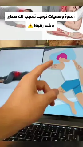 تحس بنقزات فجأة في صدرك أو قلبك يدق بسرعة بدون سبب؟ كثير من الناس يعيشون هذا الشعور، وغالبًا ما يكون السبب شد عضلي في منطقة الصدر أو التهاب بسيط في العصب الحائر، وليس مشكلة في القلب نفسه. أكثر المسببات تكون: توتر، قولون عصبي، شد الرقبة أو نوم غلط. وهنا يبدأ الألم ينتشر للكتف وتحت الإبط ويعطيك نغزات مزعجة. الاستخدام المنتظم لـ دهان الحنظل يساعد على تهدئة الشد العضلي وتخفيف التوتر حول الصدر والكتف، ويعطي راحة أسرع في الأوقات اللي يزيد فيها الانقباض. استخدمه بتدليك خفيف مرتين يوميًا وشوف الفرق بنفسك. #نقزات_القلب #العصب_الحائر #الم_الكتف #شد_العضلات #الم_الصدر #دهان_الحنظل #توتر #قولون_عصبي #صحة #السعودية #fyp #viral 