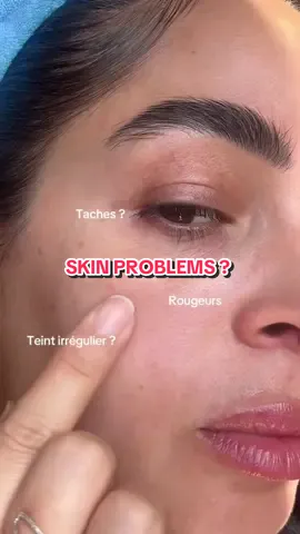 Déjoues les taches boutons et rougeurs grâce a ce combo parfait de @KSECRET GLOBAL  Dispo sur @YesStyle : -10% NESS1234 #glowshotchallenge #seoul1988 #ksecret #darkspots #collagen 