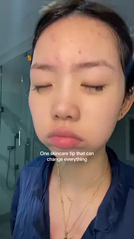 ဝက်ခြံ၊အဆီဖုနဲ့ ဆားဝက်ခြံပျောက်ချင်ရင်ဒီအချက်တွေမလုပ်ပါနဲ့ ❌❌#ဆားဝက်ခြံပျောက်ချင်သူများအတွက် #teပျားမျက်နှာသစ် #ခိုင်ဖူး #အိမ်အရောက်ငွေချေမှာယူနိုင်ပါတယ်ရှင့် 