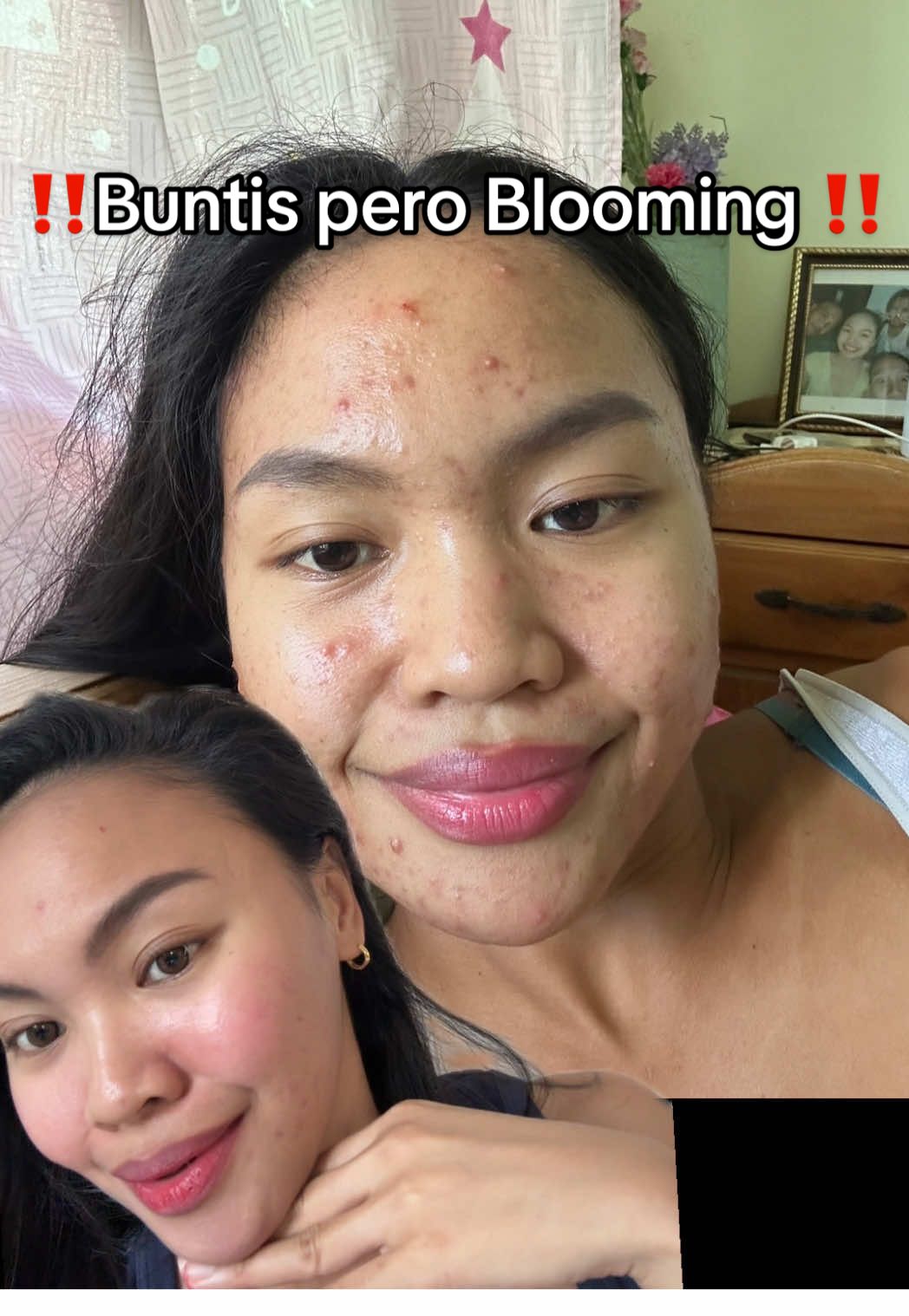 Sabi ko sa inyo pagkatapos ko dito Tatambay nnman ako sa    📍PrettyandcalmPasig @Niña Mariedoll Aclan  #fyp #acnetreatment #pregnancy 