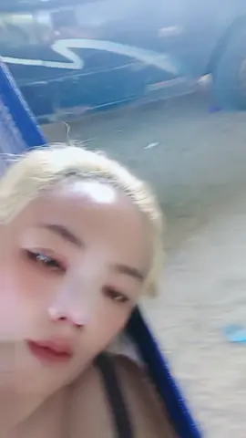 วันที่สองละเริ่มบวมๆละ