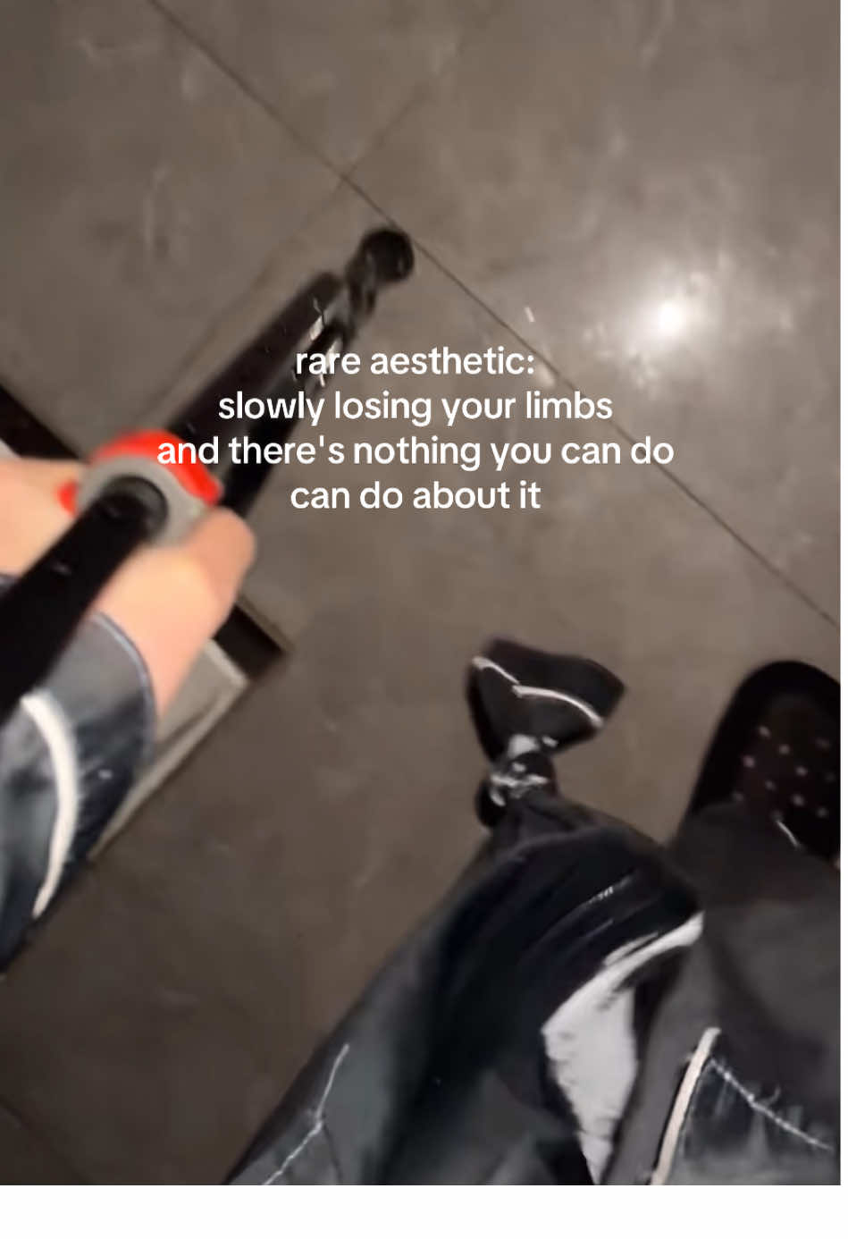 I'm fighting to save my other leg now #fyp #amputee #disability #MentalHealth #foryoupage 