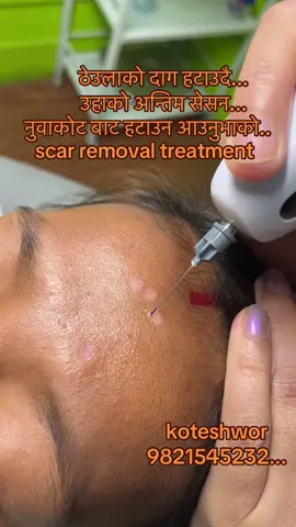 #chikenpocks #daag #scar #fyppppppppppppppppppppppp #goviral 