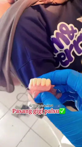 Minat pasang gigi silahakan dijamin rapi #cikarangselatan #cikarang #citraindahcity #gigipalsu#fypシ゚ 