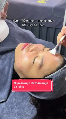 Manifest tháng mới khách đến tấp lập , học viên đăng khí khoá học đều đều #xuhuong #peel #mun #munviem #lamdep . Mụn viêm mụn ẩn sợi bã nhờn mụn bít tắc dập viêm sau 1 buổi 