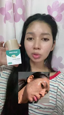 ต้องลอง #ส้มโอที่หน้าเป็นสิว #ป้ายยาtiktok #แผ่นแปะซิลิโคน #แผ่นแปะซิลิโคนเจล #ป้ายยา 