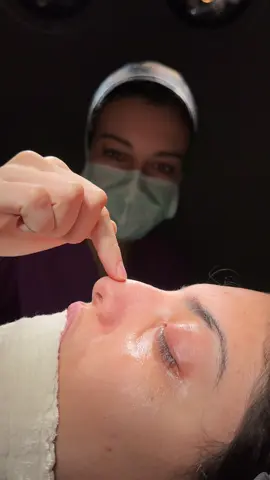 Barbie Nose Turkey🔥 . . . #barbienoseturkey#nasenkorrektur#rhinoplastybeforeandafter#rhinoplasty#rinoplasti