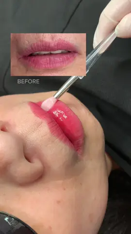 Môi sau bong cho cô khách u70 🫢 #tuyennguyenphunxam #khuthammoi 