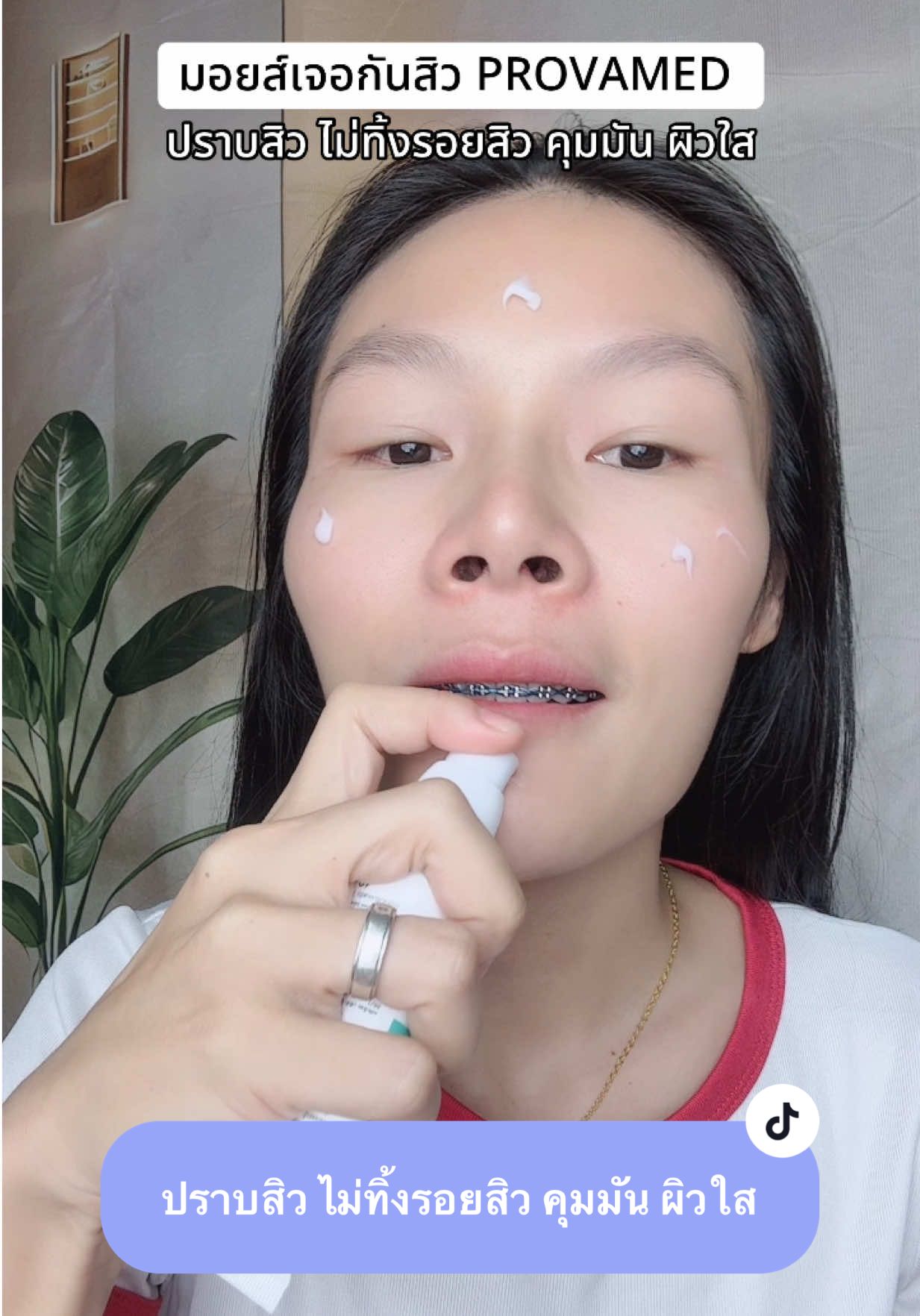 #มอยส์เจอร์กันสิว #มอยส์เจอโปรวาเมด #โปรวาเมด #มอยส์โปรวาเมด #มอยส์เจอร์ไรเซอร์ 