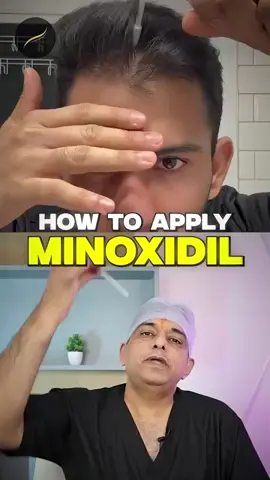 Whatsapp 0315 36 55 565 #minoxidil #hairgrowth #hairlosstreatment #hairrestoration #scalphealth
