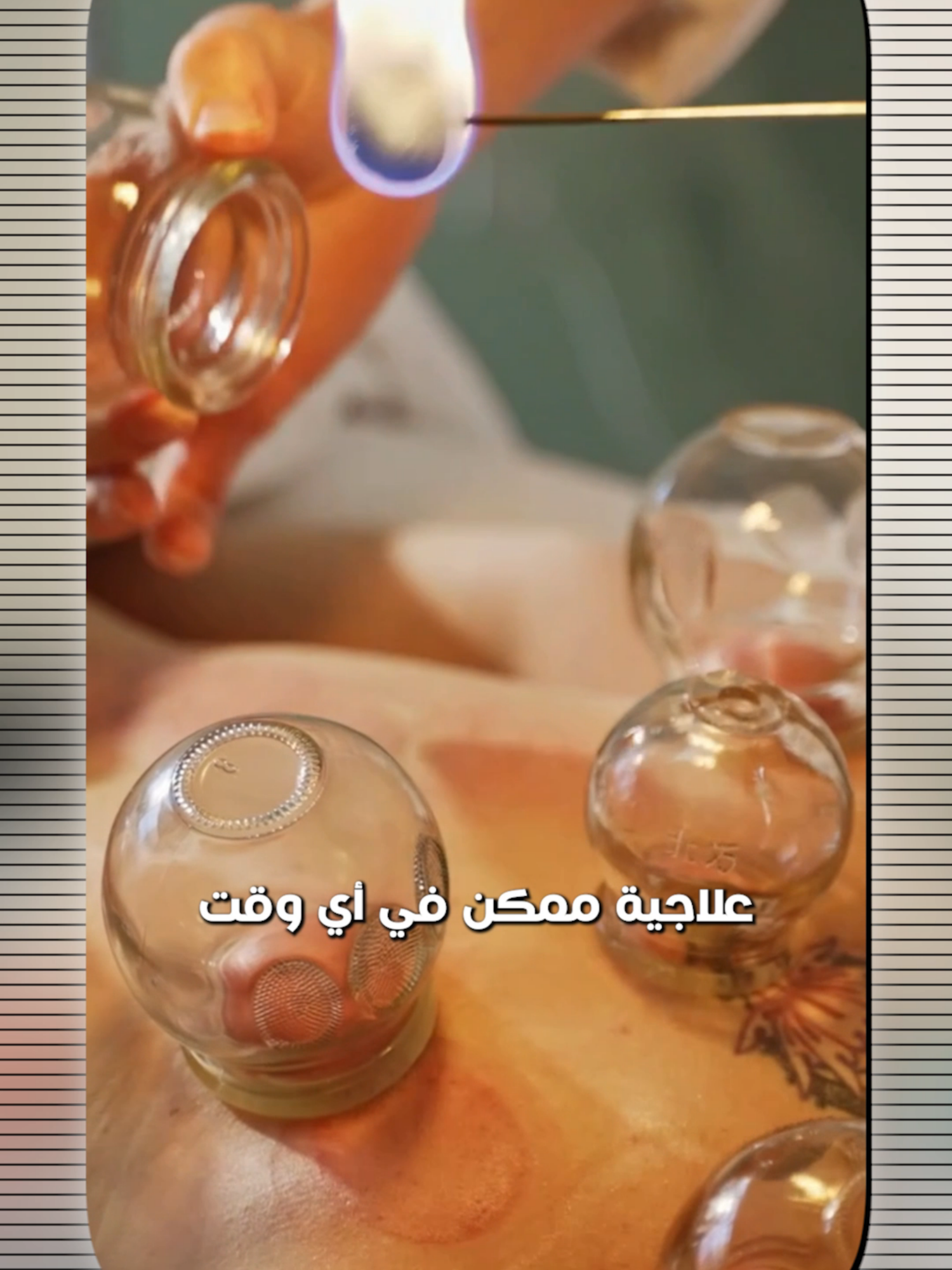 إجراء الحجامة الوقائية في أيام 17 و 19 و 21 يعتبر من أهم الفرص للاهتمام بصحة جسمك 💪🌿 في هذا الفيديو، يوضح الدكتور هيمن أهمية إجراء الحجامة في هذه الأيام وفق التقويم الهجري 📅 تابع الفيديو ولا تنسَ تحجز موعدك لتستفيد من جلسة الحجامة الوقائية 📩✨ 📍 العنوان: شارع الملك عبدالعزيز – القاسمية – الشارقة 📞 للتواصل: 0563339460 | 065720088 #دكتور_هيمن #الحِجامة_الطبية #الطب_الشمولي Performing preventive cupping on days 17, 19 & 21 is one of the best ways to support your body’s health 💪🌿 In this video, Dr. Haiman explains the importance of doing cupping on these days according to the Hijri calendar 📅 Watch the video and don’t forget to book your appointment to benefit from a preventive cupping session 📩✨ 📍 Address: King Abdulaziz Street – Al Qasimia – Sharjah 📞 Contact: 0563339460 | 065720088 #DrHaiman #MedicalCupping #HolisticMedicine