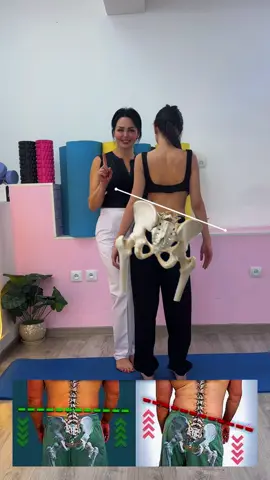 Exercise for a shortened muscle and pelvic misalignment Lift the shortened leg up and down in a controlled way, activating the deep muscles and keeping the pelvis stable. 🔹 Movement: up – down 🔹 Breathing: calm and controlled 🔹 Hold at the top: 3 seconds 🔹 Repetitions: 10 times 🔹 Sets: 3 🔹 Frequency: daily This exercise helps to: ✔ activate weak muscles ✔ lengthen shortened muscles ✔ improve pelvic position ✔ restore body symmetry Dr. Marina Ispiryan 📍 Armenia, Yerevan 📲 WhatsApp: +374 98 149 914 🌐 Website: verginiacenter.com 📩 Online & Offline sessions available #Scoliosis #ScoliosisTreatment #PostureCorrection #PelvicTilt #UnevenHips          