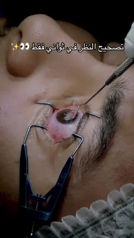 👀✨ كل التقنيات تصحيح النظر في عيادة واحدة    عندنا نمدولك كل الحلول لي توالمك باش ترجع شوفتك  نوفر لك كل تقنيات تصحيح النظر بالليزرLASIK،  , presbylasik FemtoLASIK، StreamLight ، Contoura، SMILE…” و زرع العدسات  لان كل عين لها علاجها الخاص وواجبنا نختار الأنسب لك، بأحدث الاجهزة  لي راح يضمنلك نتائج دقيقة و دائمة و دون ألم  “في دقائق… ترجع تشوف الحياة بوضوح!” ‎استفيدوا من أفضل التقنيات والابتكارات لعلاج أعينكم في عيادة حموش لطب العيون  ❤️  للمزيد من المعلومات و لحجز موعد تواصلوا معنا على الرقم :  0783672006 #ophtalmologie #fyp #تصحيح_النظر #طب_العيون #algerie 