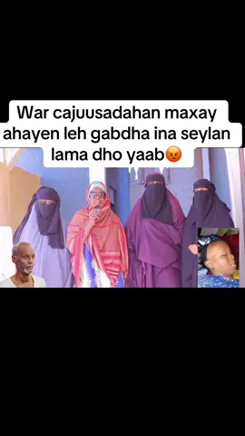 Cawa wa yaabay kulaha abe maleh hadana waxan ahay eedadeed xagy iska dhaafsan tahay habartan 