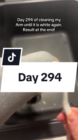 Day 294 of cleaning my arm. #day1 #day501 #cleaning 