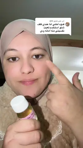 #علاج_الكلف #الكلف #تصبغات_الوجه #ليطاش_حبوب_اثار_حبوب #كلف_نمش 