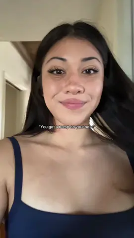 #nosebridge #beauty #nose 