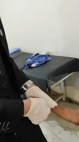 رفع المسامير النخاعيه  #دكتور_إيهاب_جعفر  #fyp 