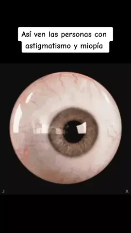 Sigan 📲@PacificssharkTaboga❤️🙌🏻🍽  #condicionesmedicas #miopia #astigmatismo #vision #vista 