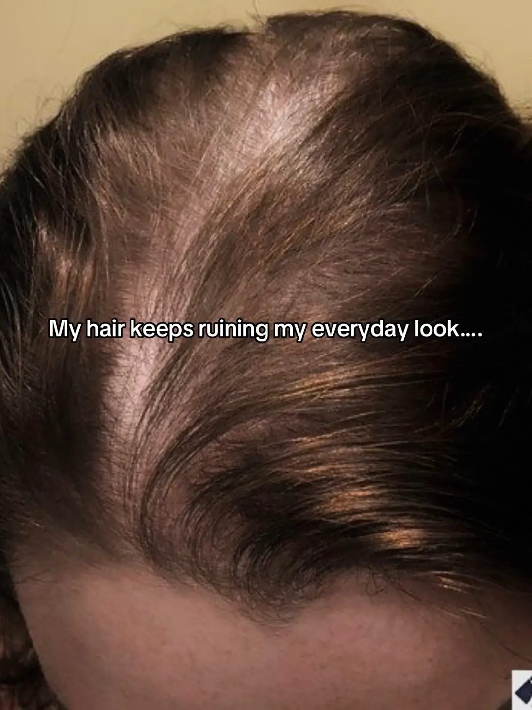 #hairgrowth #haircare #glowuptime #selftime #hair 