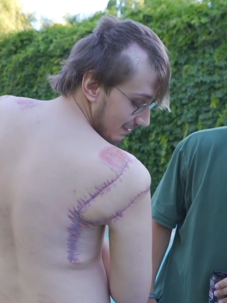 me reconstruyeron #brunenger #coscu #clips #twitch #stream 