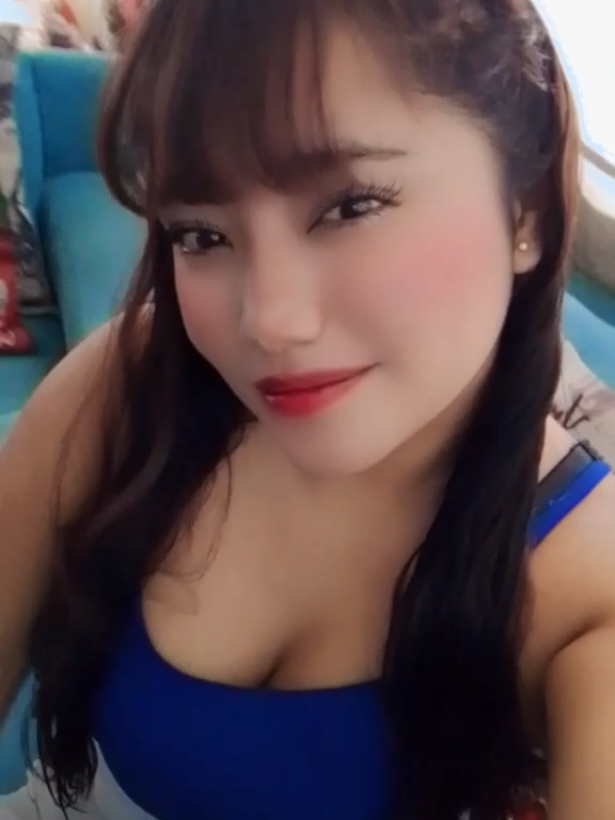 corriendo de seguro jajaja 🤣😭 #fracturadetobillo 