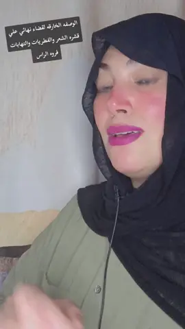 الوصفه الخارقه لقضاء نهائي علي قشره الشعر والفطريات والتهابات فروه الراس #قشرة_الشعر #التهابات #فروة #الراس #معالجات_شعر 