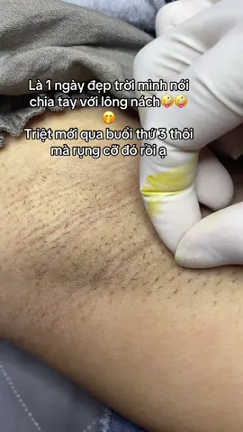 Triệt nách diode laser #trietlongtanphu #trietdiodelaser #trietlong #trietnachtanphu #xuhuong 