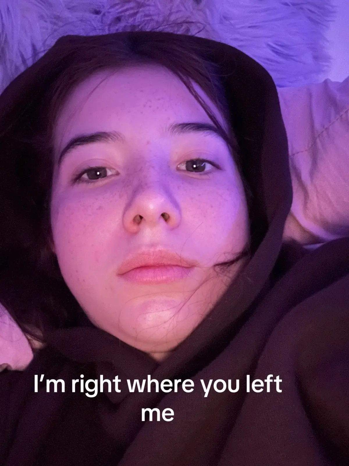 Both no makeup to make it fair🫰