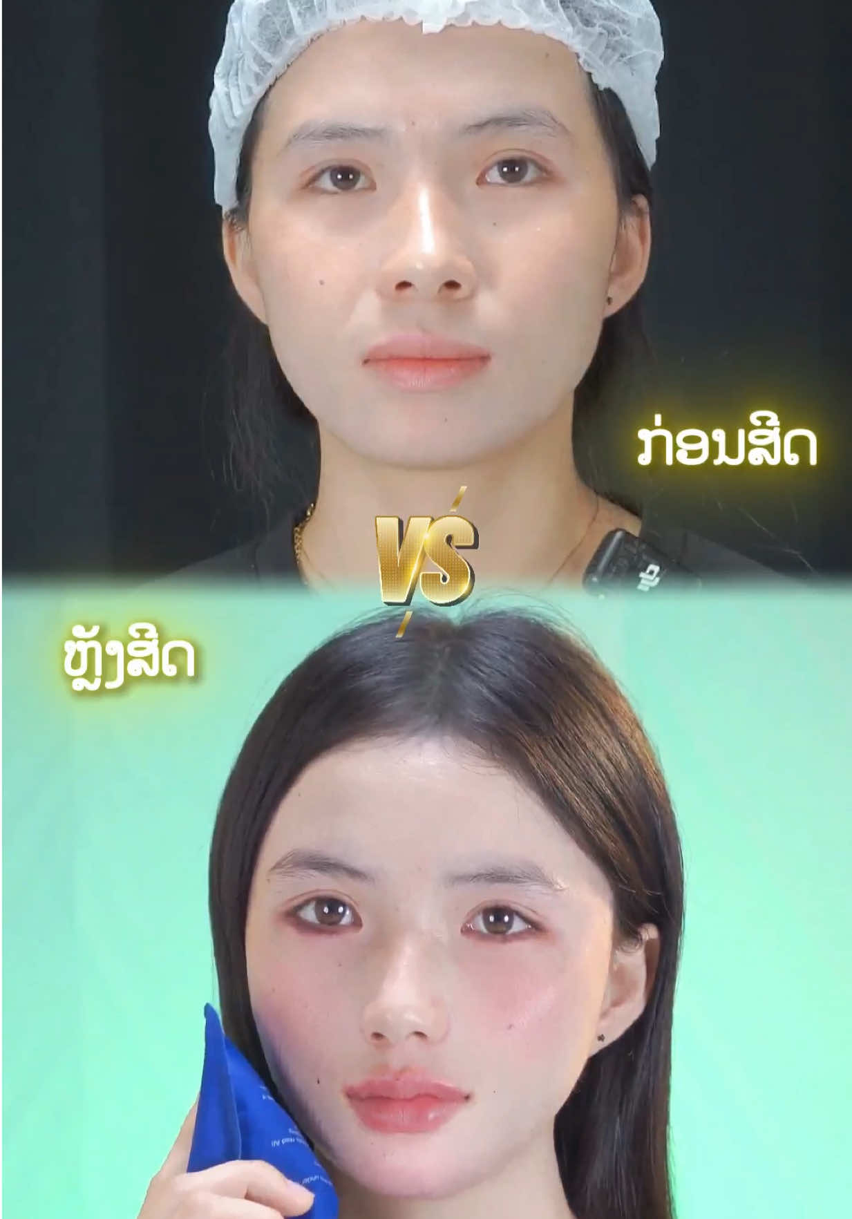 #ປັບຮູບຫນ້າ #beauty #viral  #fyp 