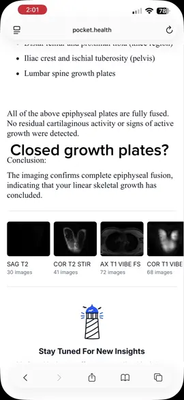 Infinite height glitch, first to do it. #bp #tall #growtaller #growtallertips #growthplates 