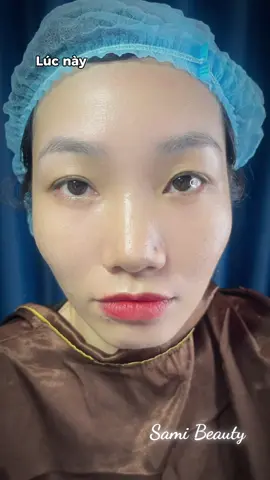 #CapCut Nhấn mí làm đẹp thôi các nàng ơi, sắp tết rồi ❤️ #lamdep #spabaria #nhấnmí #xuhuong 