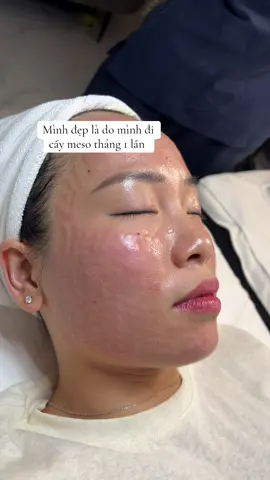 #meso_trắng_da #meso_căng_bóng_trắng_sáng #mesocấp_ẩm #meso_căng_bóng 