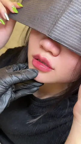 • M.O.I Baby Xinh iêu cho K.H iêu nhà em 🥰   • K.H đã từng tiêm nhà em nay quay lại tiêm cover form cũ ạ  • Môi gốc siêu mỏng và cụp buồn 🥰 #tiemmoi #tiemmoixinh #filler #tiemmoicherry #amienguyenbeauty  