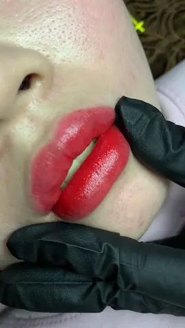 Xin #chamsocdamun#chamsocdaseo#chamsocdanam#tanbinh#Lqspa&academy