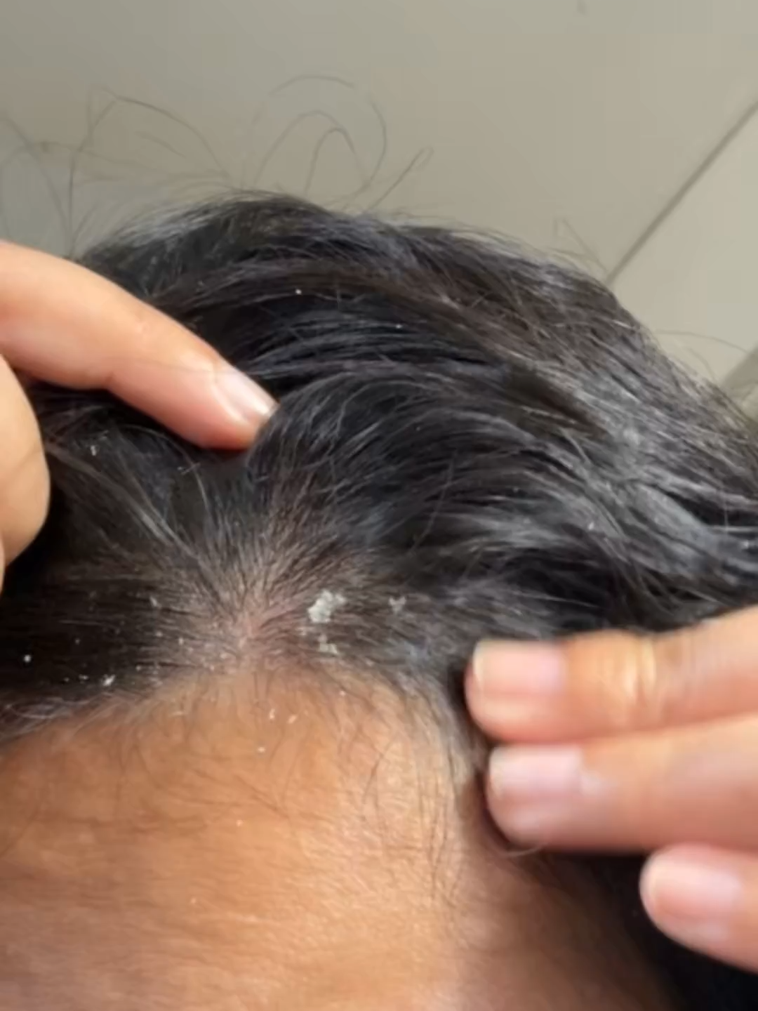 Biocarephar user experience #23 #CleanWithBio #BiocarepharPH #NoMoreDandruff #HaircarePH