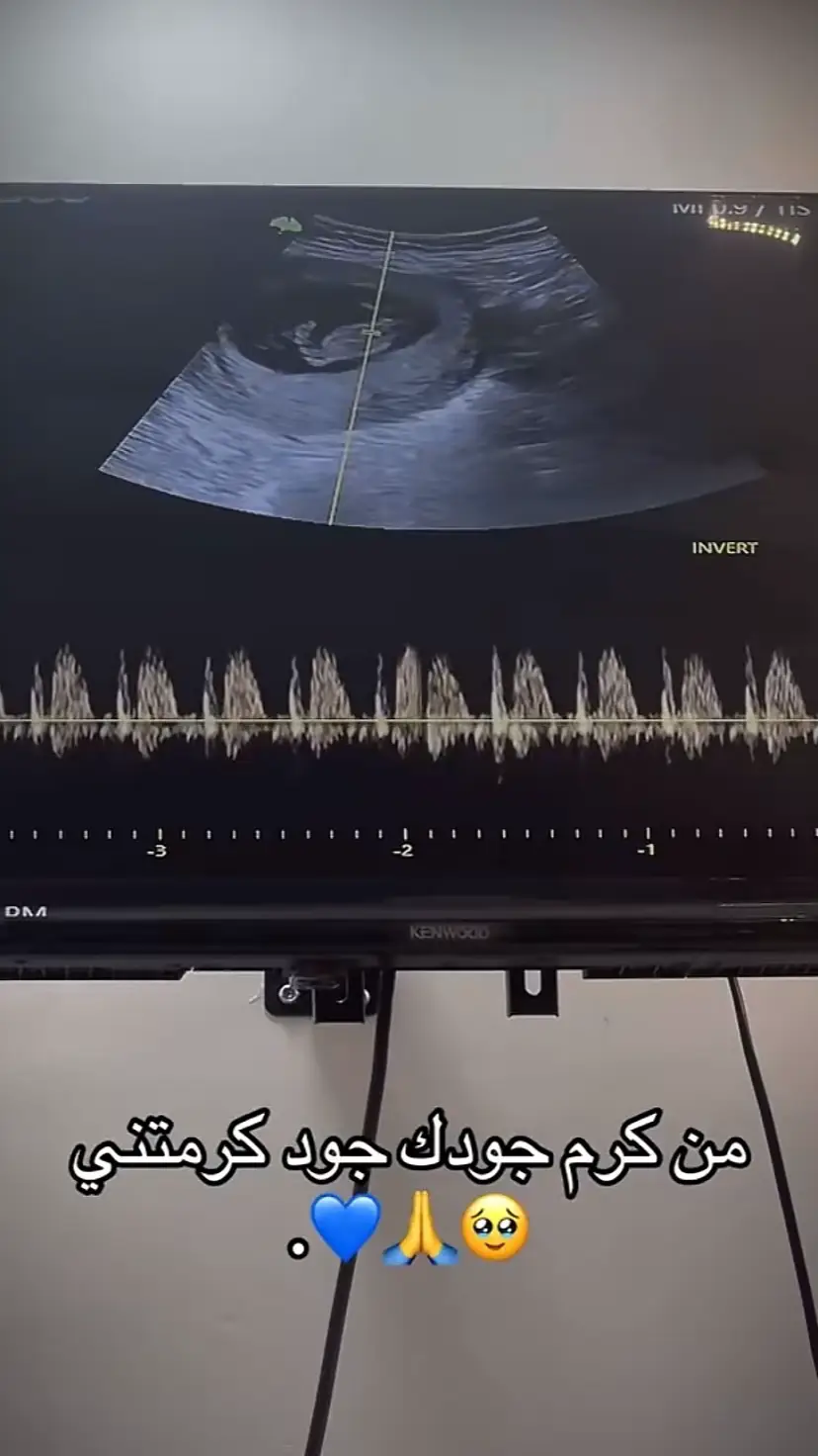 #من_كوم_جودك_جود_كرمتني🦋🥹❤️  #حوامل_الشهر_التاسع #يارب_سهل_ولادتي🥺💙 #يارب_ارزق_كل_محروم_الذريه #ربي_لاتذرني_فردا_وانت_خير_الوارثين 