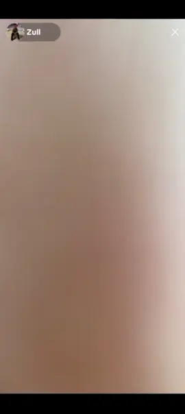 yang mau transisi aloy ini ya🫰🏻 #4upage #bantulike1k #jangnspamlikeajirr #gantengamatbang #aloyy