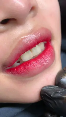 Khử thâm cho bé 2k9 vừa tròn 16 tủi siêu dễ thương #toinguyen #daotaohocvien #hanhtrinhphunxam #XuLyMoiTham #xuhuong 