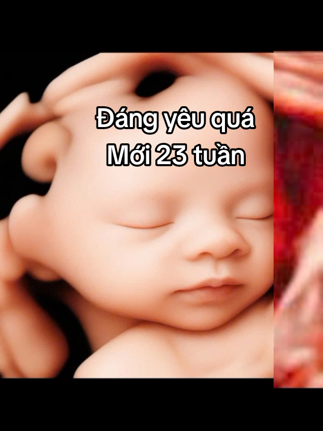 Trả lời @nt_nhatshirra em bé 23 tuần mà rõ nét quá #dunghinhsieuam #sieuam5d #thacsiphuoc #mebau 