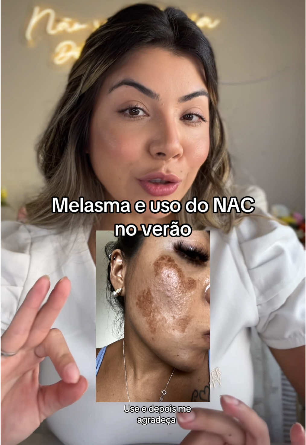 Você já sabia disso ?  Me conta nos comentários, e quem já testou, me conta o que achou ? 👇🏻 #melasma #nac #provit #manchas #mulheres 