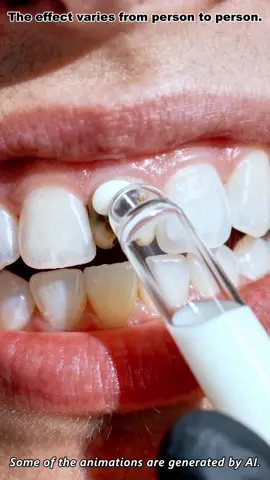 Say Goodbye to Yellow Stains#beamachtoothpaste #hydroxyapatitetoothpaste #blackfriday #blackfridaydeals #blackfridaysale 