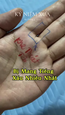 Tay có khe thoát tài