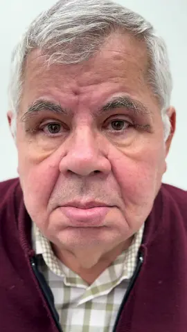 Ati cerut rezultatul pacientului, iata cat de bine arata la două saptamani de la intervenția de blefaroplastie superioară  #drlevymedicalcenter #plasticsurgeonsoftiktok #blefaroplastia #blefaroplastica #viralvideos 