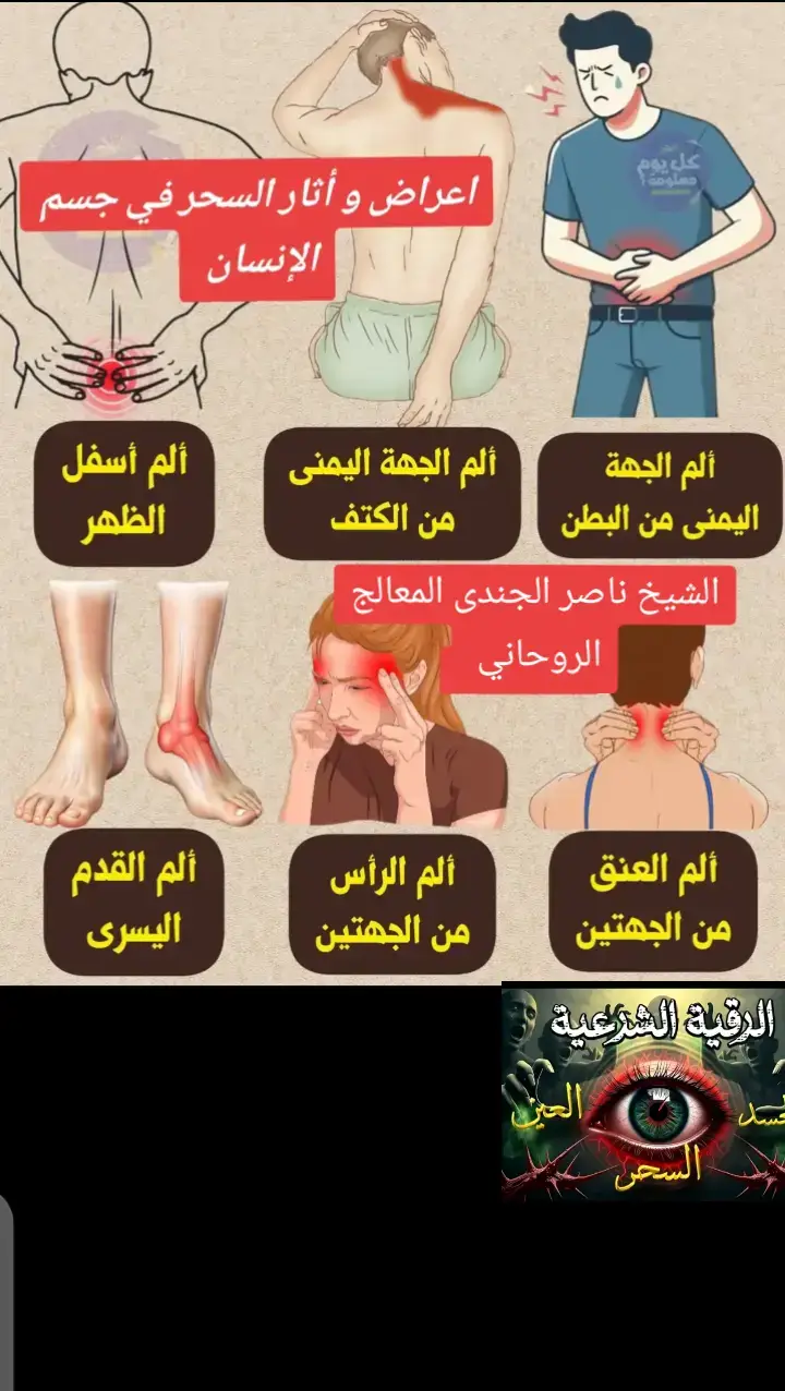 أعراض السحر على الجسد قد تظهر على شكل آلام أو اضطرابات لا تفسير طبي واضح لها: 1) آلام بالجسم صداع شديد بلا سبب. ألم متنقّل في الجسم (مرة في الظهر، ثم القدم، ثم البطن…). ثِقل شديد في الكتفين والرقبة. خمول مستمر رغم النوم الكافي. 2) اضطرابات النوم أرق متكرر، صعوبة في النوم. كوابيس مخيفة أو رؤية حيوانات سوداء (قطط، كلاب، ثعابين) الشعور بالسقوط عند النوم 3) أعراض الجهاز الهضمي انتفاخات أو مغص دون سبب طبي. فقدان أو زيادة في الشهية فجأة. قيء أو غثيان (خصوصًا بعد سماع أو قراءة الرقية). 4) شعور غريب داخل الجسد وخز في الأطراف. نبضات أو اهتزازات في أماكن معينة. حرارة أو برودة شديدة في موضع محدد.#القران_الكريم_راحه_نفسية😍🕋 #المعالج_الرياضي_بغداد #الرقية_الشرعية #السنه 