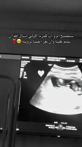 #CapCut #بييي #bebe #صغيري #حب 