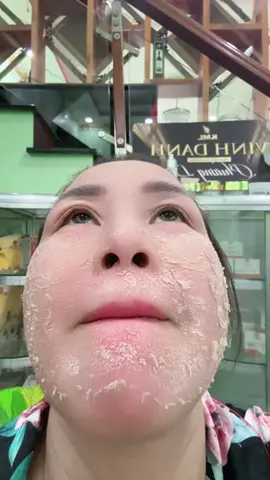 Bong như này thì sạm nán tàn nhang đồi mồ da không đều màu mụn sao chịu nổi#xuhuong #mun #namtannhang #vip #chamsocdachuyensau 