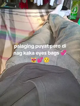 #eyebagsremover #camoueyerescue #eyebags #fyp #fypviralシ 